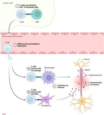 Autoreactive lymphocytes in multiple sclerosis: Pathogenesis and treatment target